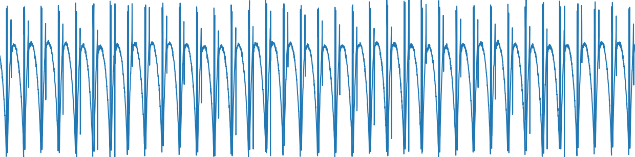 1KΩ - 10μF