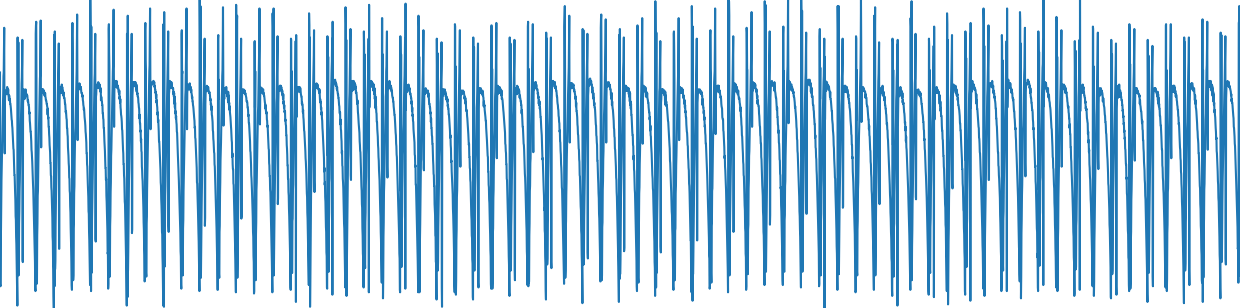 1KΩ - 4.7μF