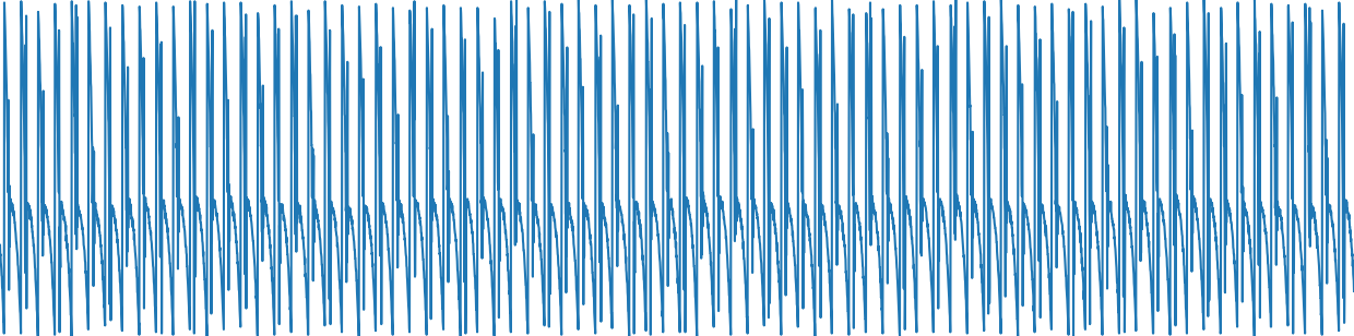 5KΩ - 1μF